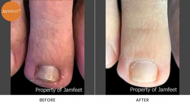 Toenail