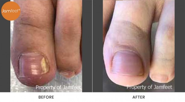 Toenail