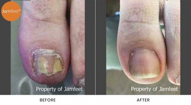 Toenail