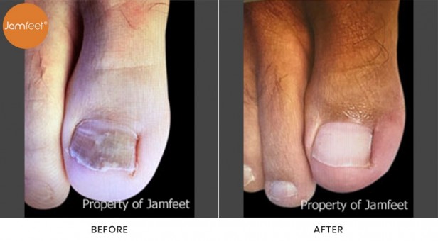 Toenail