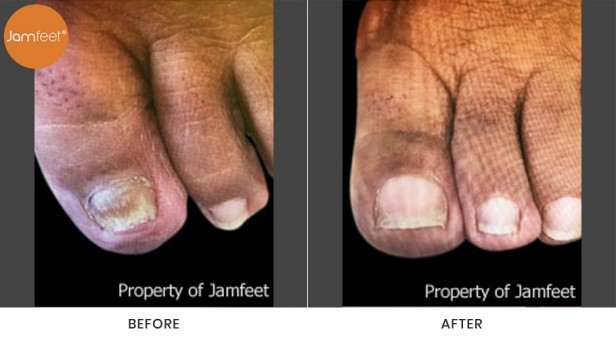 Toenail