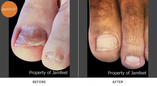 Toenail