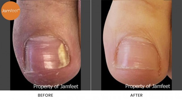 Toenail
