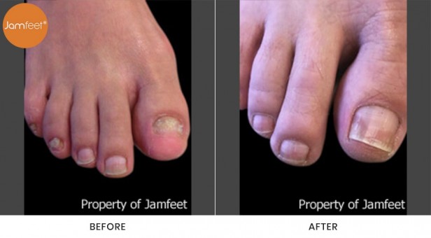 Toenail