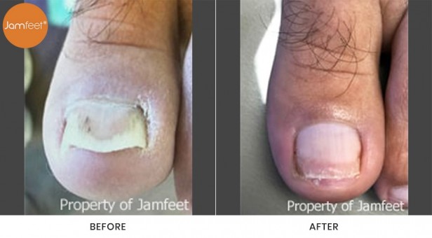 Toenail