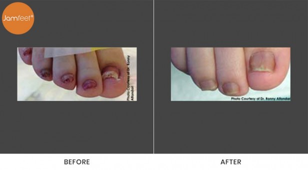 Toenail