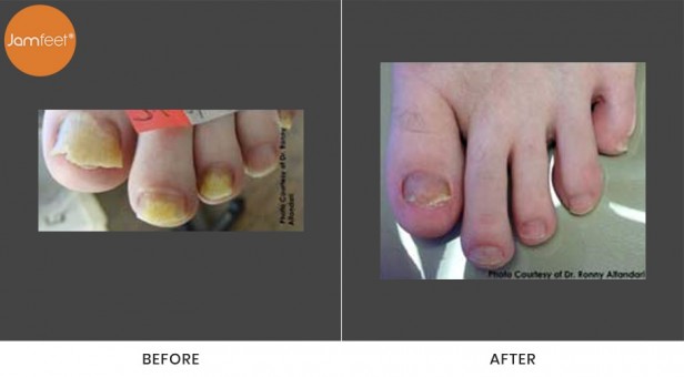 Toenail