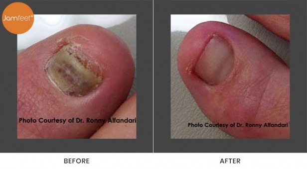 Toenail