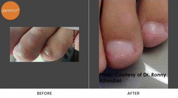 Toenail