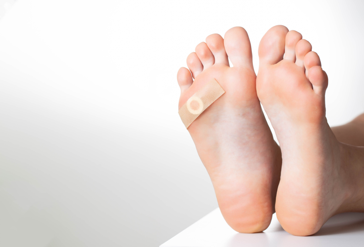 Featured image for What Causes Warts to Develop?