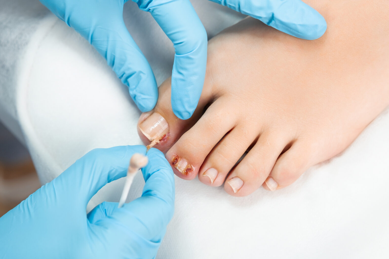 Water Toe Line The Most Common Toe Problems | Tower Foot and Ankle