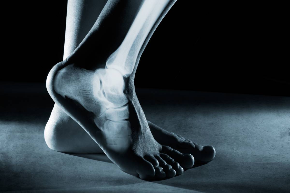 featured image for top ankle fracture treatments
